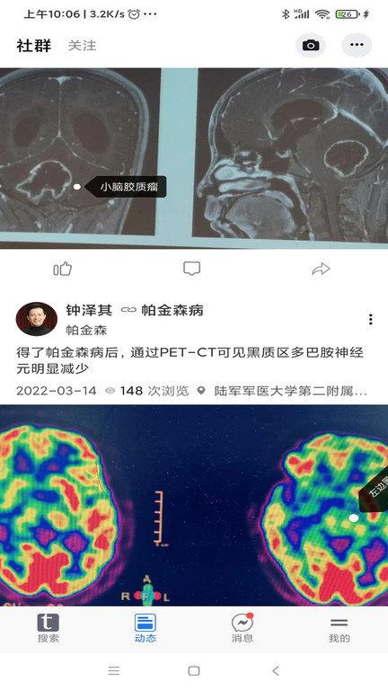 狄普医生病人端app下载,狄普医生,问诊app,医疗app
