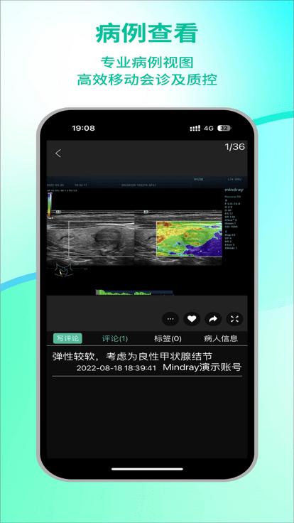瑞影云平台(ultrasync)下载,瑞影云,医疗影像app,智慧医疗app